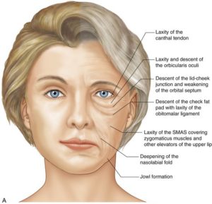 aging face cheeks